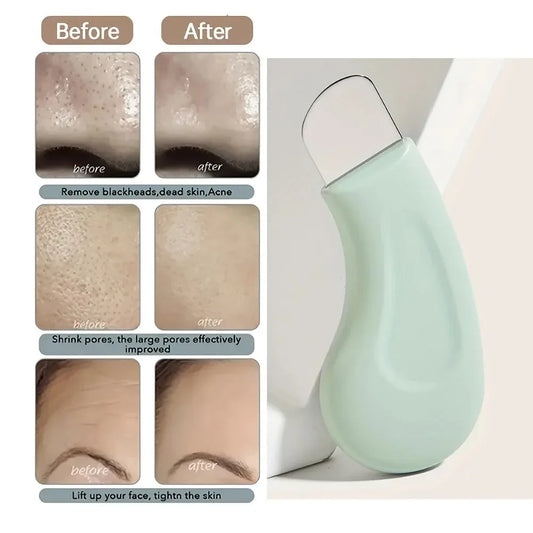 Manual Stainless Steel Blackhead Scraper & Pore Cleaner | Dual-End Facial Beauty Extractor Tool for Acne, Dead Skin & Comedone Removal | Ergonomic Skin Care Spatula