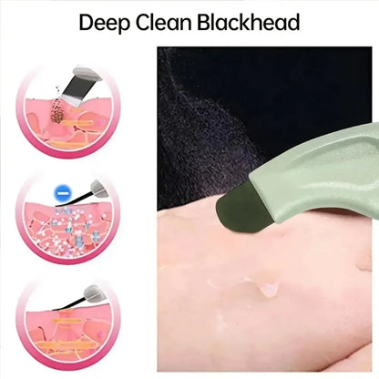 Manual Stainless Steel Blackhead Scraper & Pore Cleaner | Dual-End Facial Beauty Extractor Tool for Acne, Dead Skin & Comedone Removal | Ergonomic Skin Care Spatula